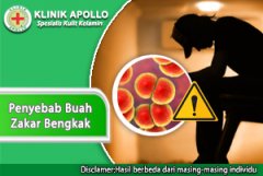 Penyebab Buah Zakar Bengkak